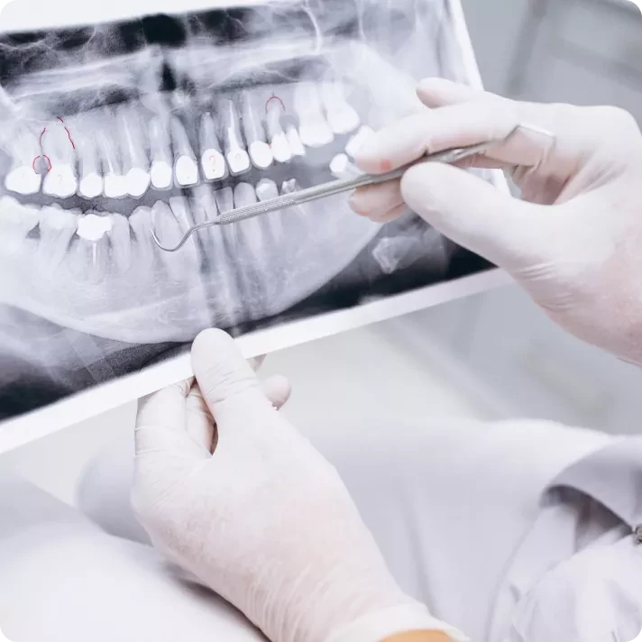 Imagistica dentară