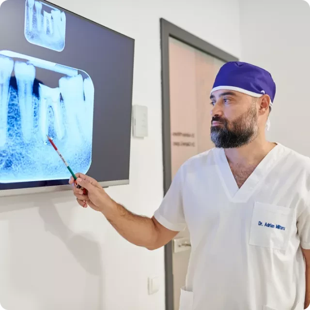 Radiografie dentară explicată