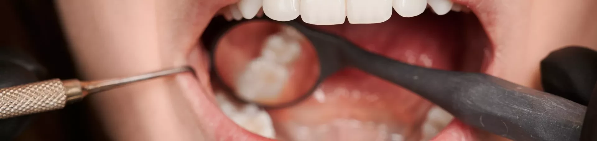 Estetica Dentara
