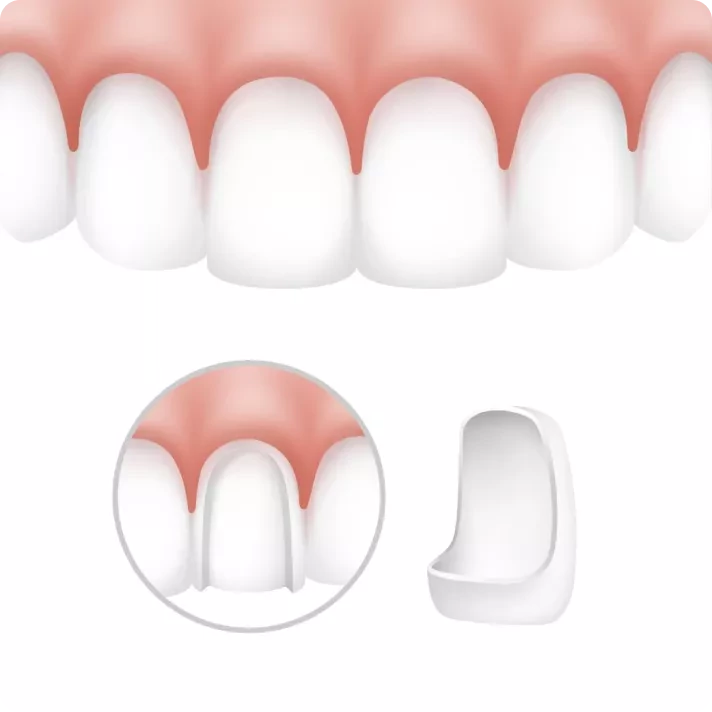 Fatete dentare