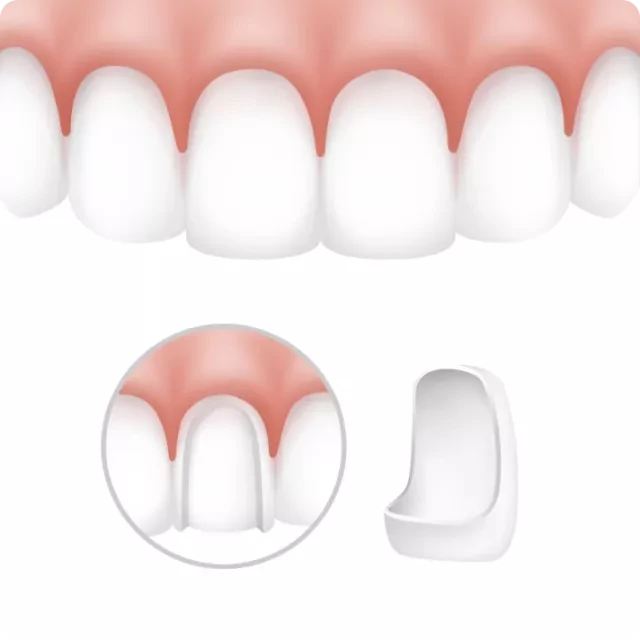 Fatete dentare